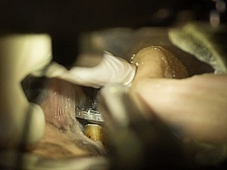 Equine Dentistry - Teeth Flaoting